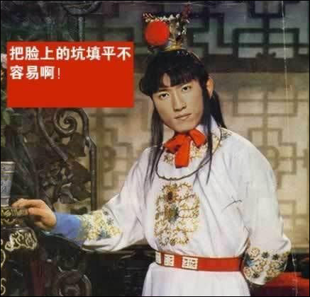 刘翔版：把脸上的坑填平不容易啊！